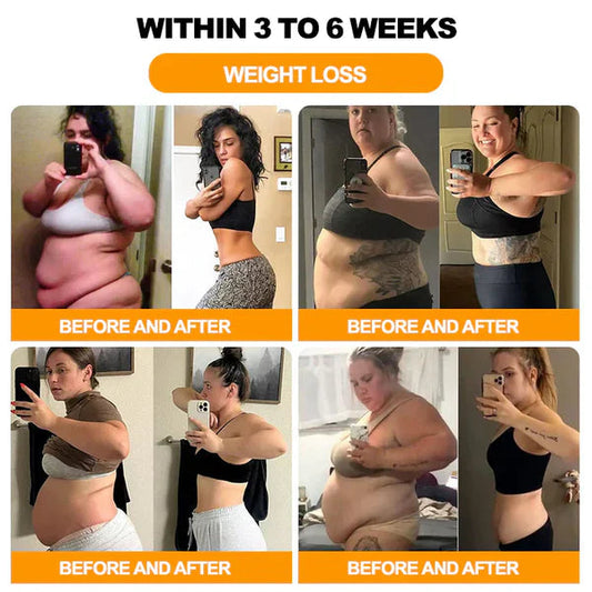 Bee Venom & Slim Foot Pads ( Buy 10 Get 10 Free) @499