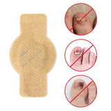 NailHeal™ - Fungal Nail Patches 🌿💅 ( Buy 10 Get 10 Free🔥🔥)